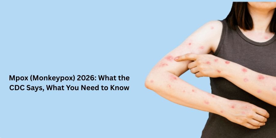 Mpox (Monkeypox) 2026: What the CDC Says, What You Need to Know