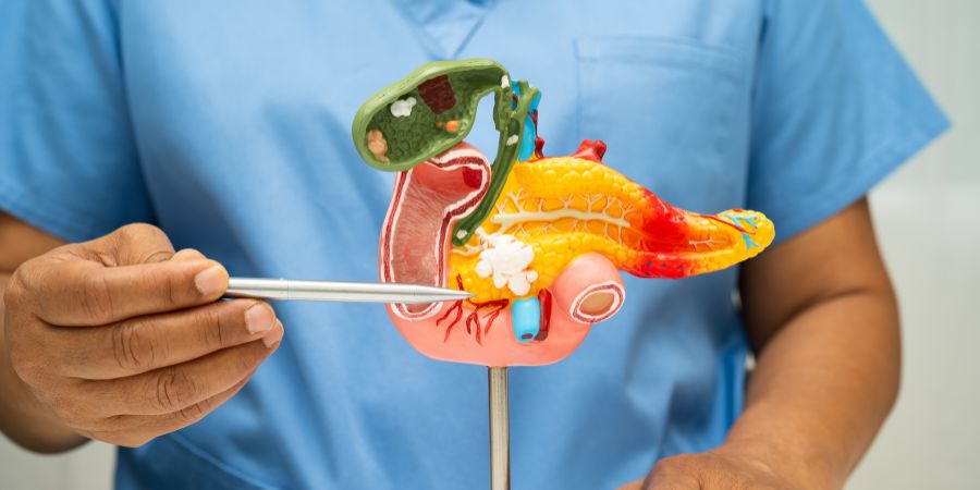Pancreatic Cancer